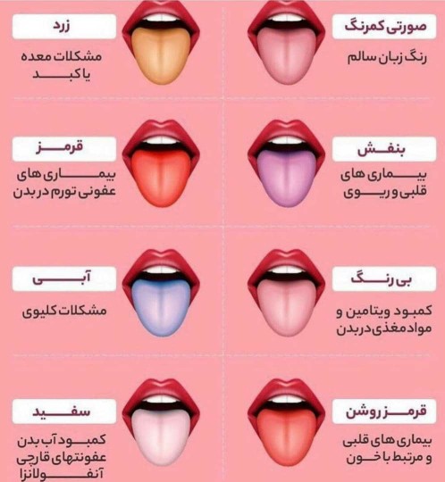 تشخیص بیماری از روی زبان بدن