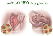 Genital warts hpv virus e1558355257982