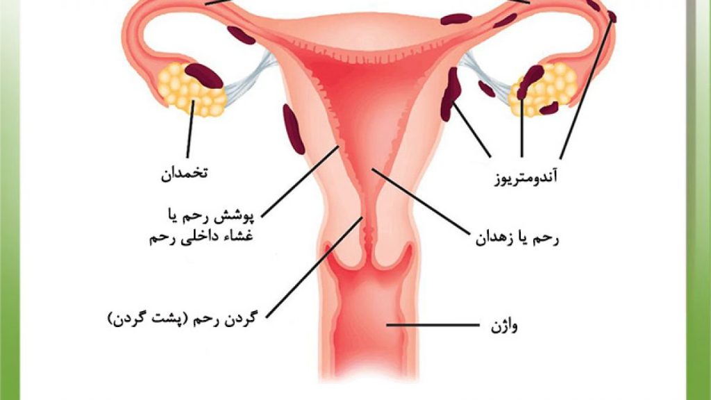 سلامت باروری برای زنان