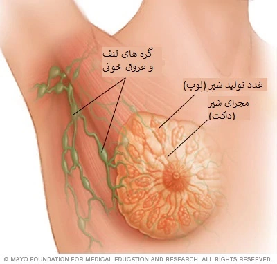 سرطان سینه سگانه منفی