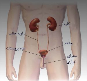 عفونت کلیه