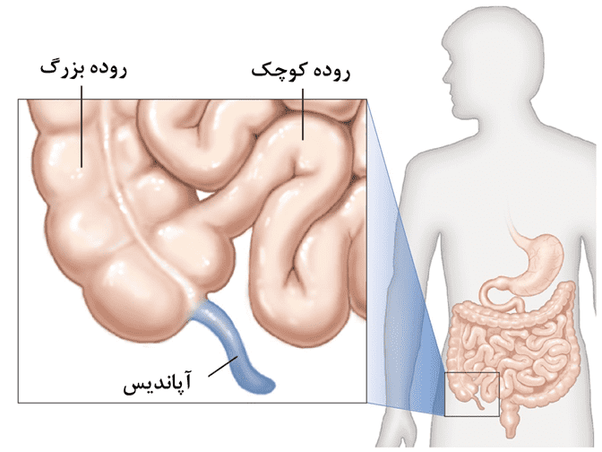 آپاندیس