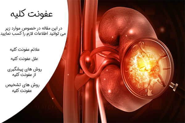 عفونت کلیه