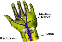 wrist pain 4 1
