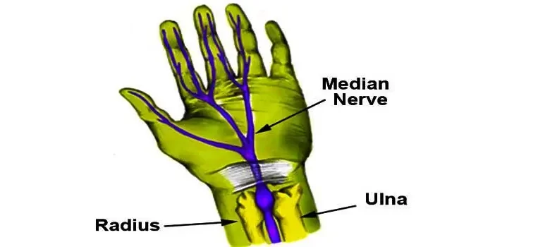 wrist pain 4 1