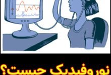 نوروفیدبک