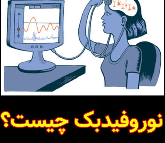 نوروفیدبک