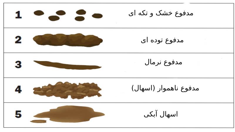 یبوست شدید