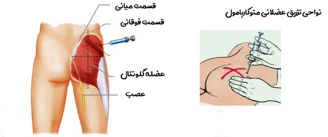 آمپول شل کننده عضلات