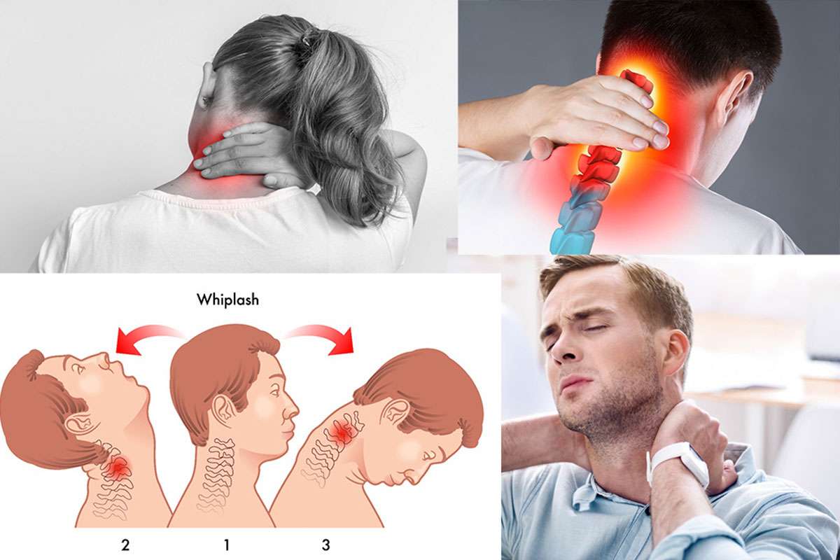 آمپول شل کننده عضلات