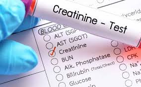 کراتینین